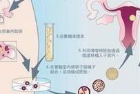 试管婴儿移植期饮食安排，14天菜谱供参考！