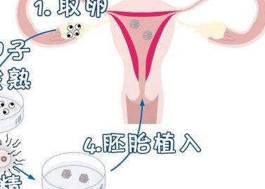 长沙试管婴儿前期检查有哪几项？